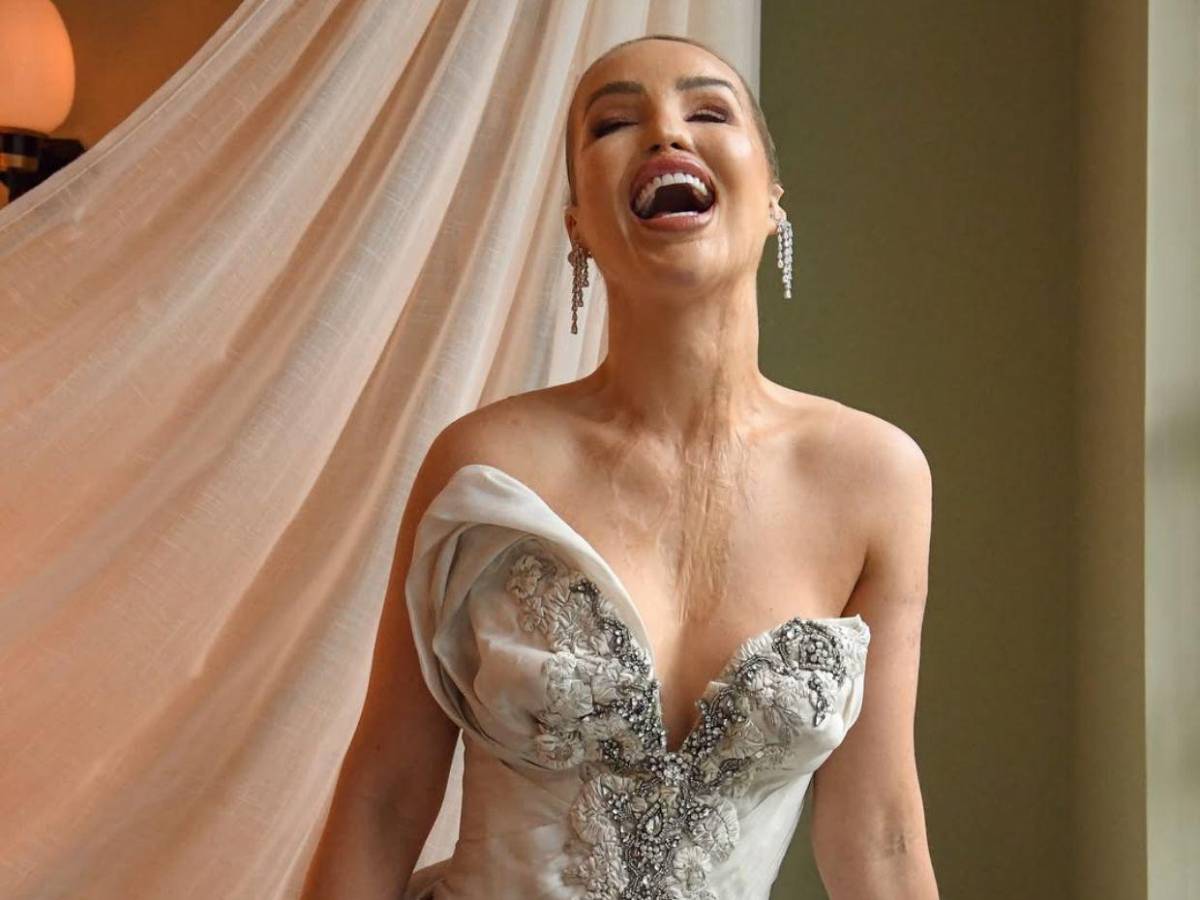 ¿Qué ha sido de Katie Piper, la presentadora a la que le tiraron ácido en la cara?