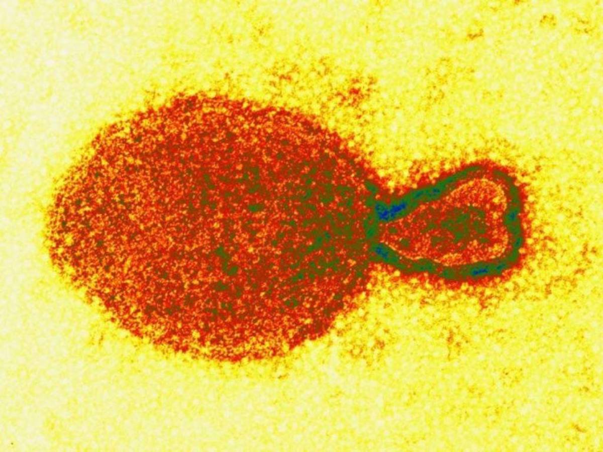 ¿Qué es el henipavirus y por qué deberíamos estar alerta?