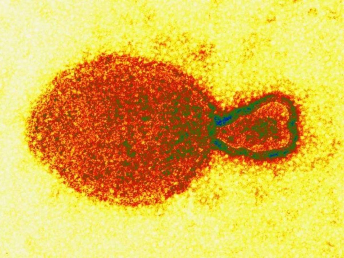 ¿Qué es el henipavirus y por qué deberíamos estar alerta?