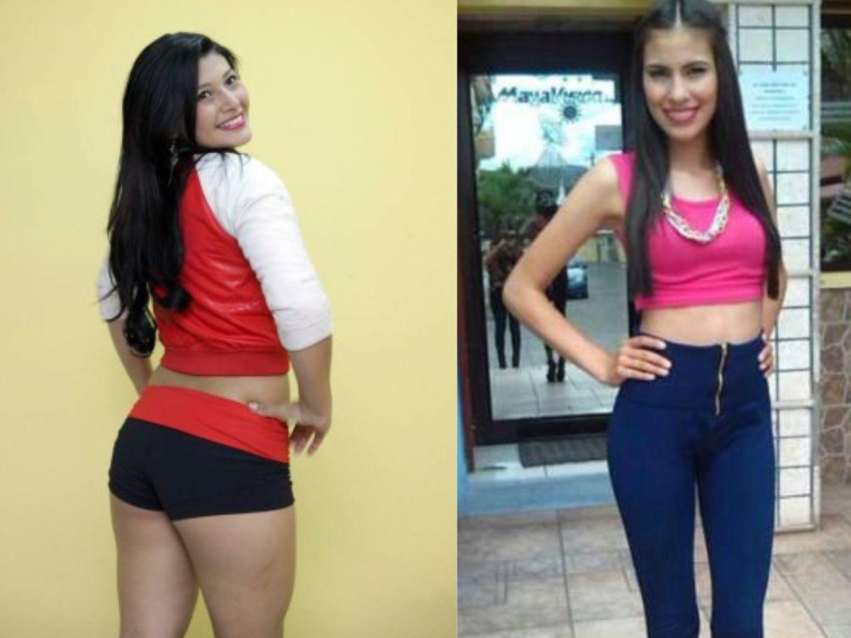 ¿Qué se retocaron? El cambio de las presentadoras hondureñas después de su operación