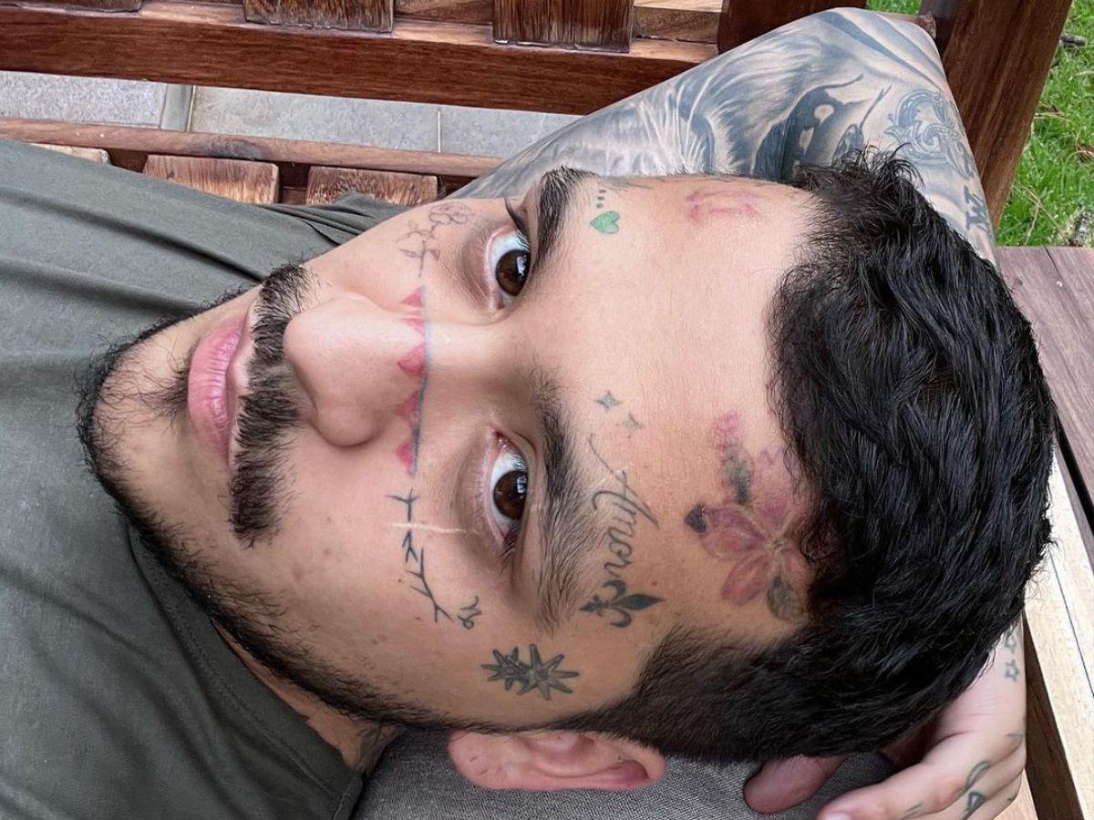 Christian Nodal muestra avances en el proceso de eliminación de sus tatuajes faciales