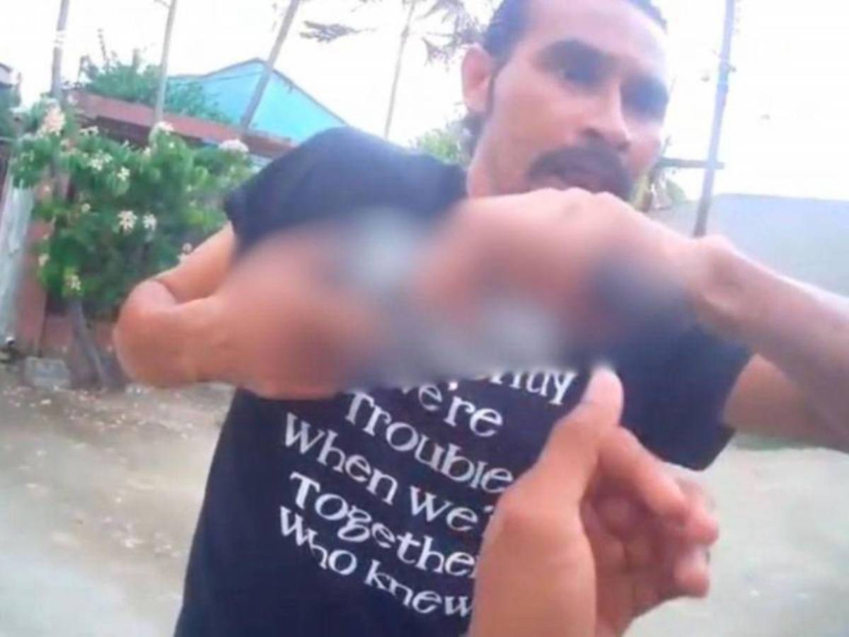 Asaltante que hirió a delivery en San Pedro Sula trabajó en el 911