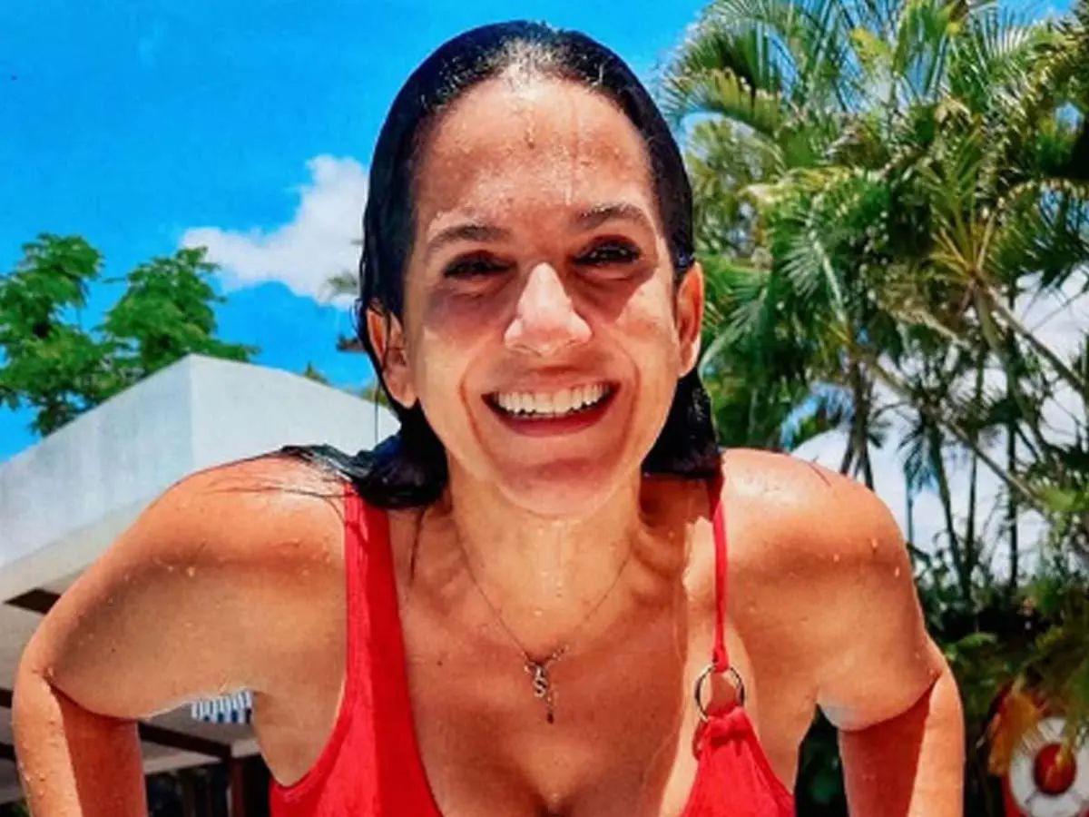 ¿Tuvo relación con su muerte? Procedimientos estéticos a los que se sometió la chef Sandra