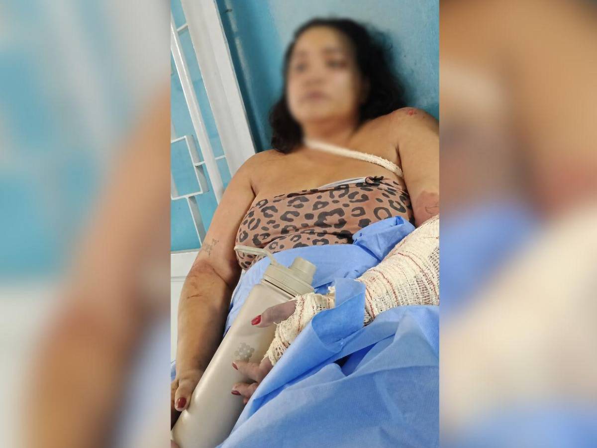 Periodista Jessiree Querales perdió un brazo y una pierna tras terremotos en Venezuela