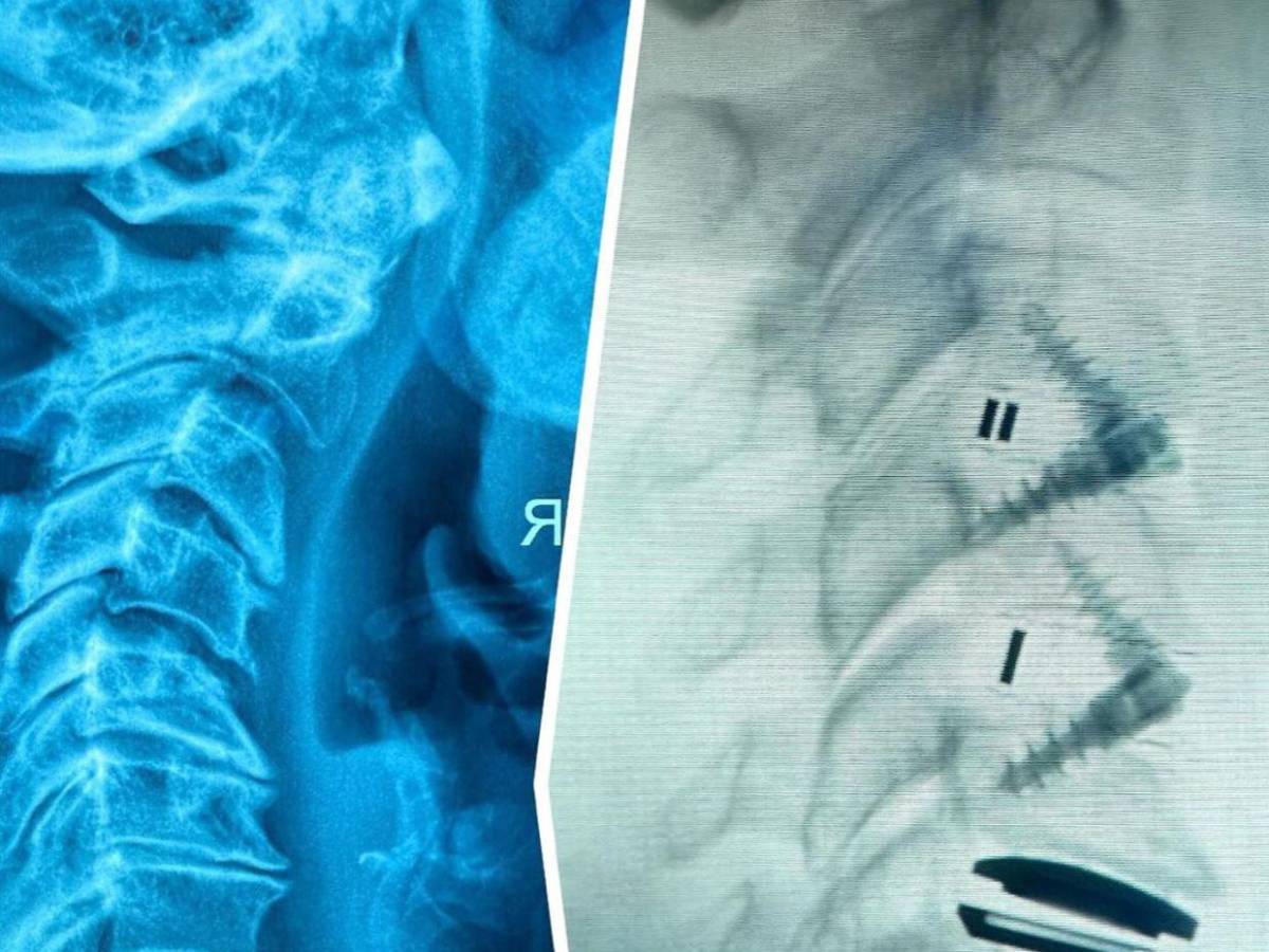 ¿Qué le pasa a Alejandra Guzmán? Su representante revela por qué está hospitalizada