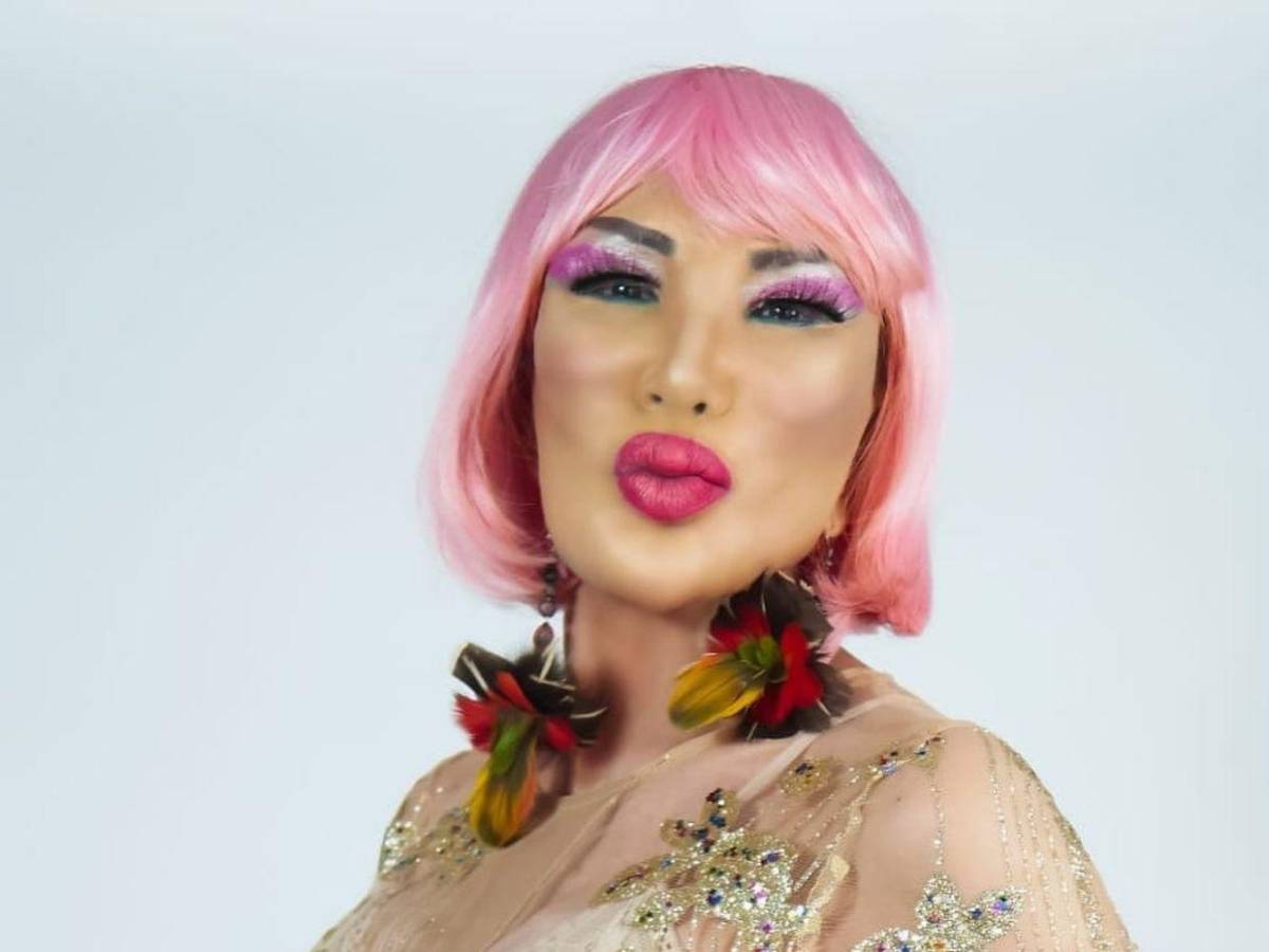 Lyn May y el error estético que deformó su rostro