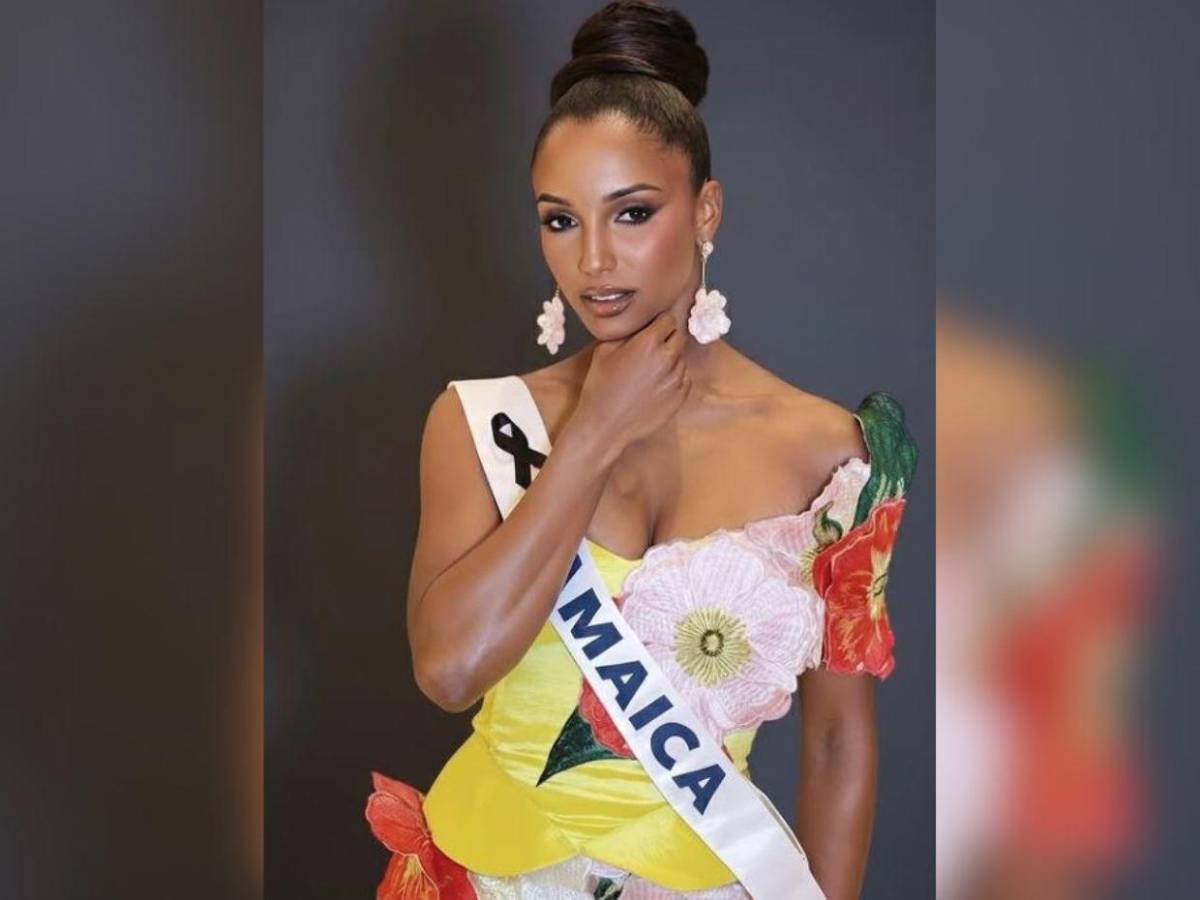 ¿Cuál es el estado de salud de Miss Universo Jamaica? Esto se sabe