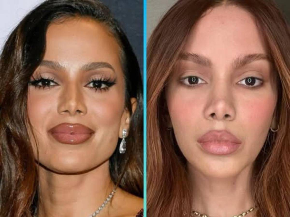 ¿Anitta se sometió a más cirugías? Mi mayor miedo es no reconocerla porque tiene nueva cara