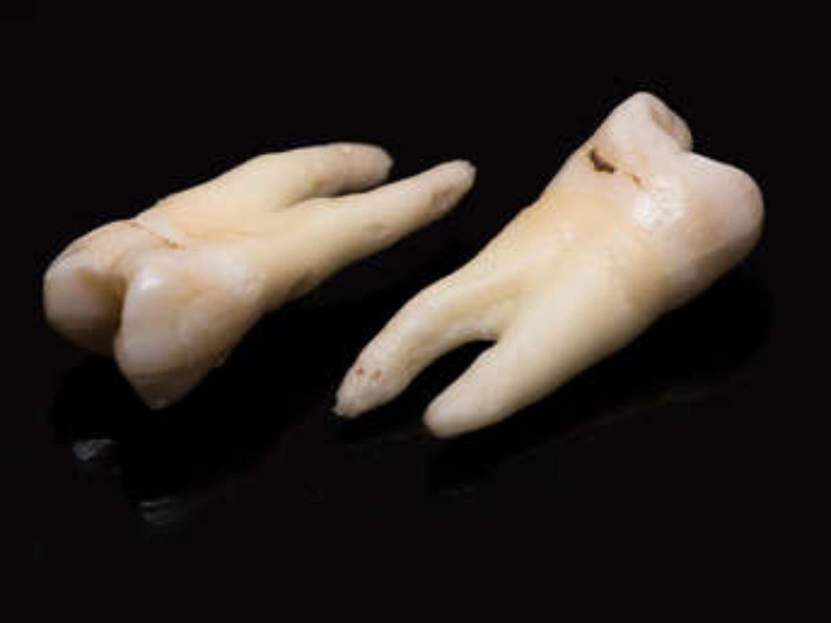 Obreros hallan centenares de dientes en el techo de un edificio de 1960