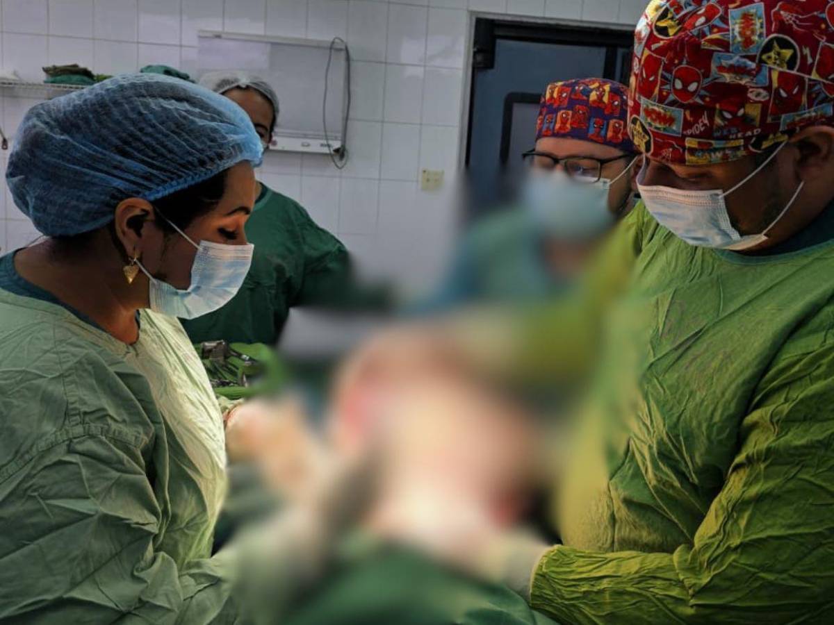 Le extirparon un quiste de ovario que pesaba 20 libras: el caso de una mujer de 64 años en el HE