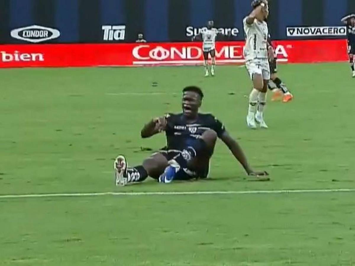 Así fue la espeluznante lesión de tobillo que sufrió Jean Pierre Arroyo