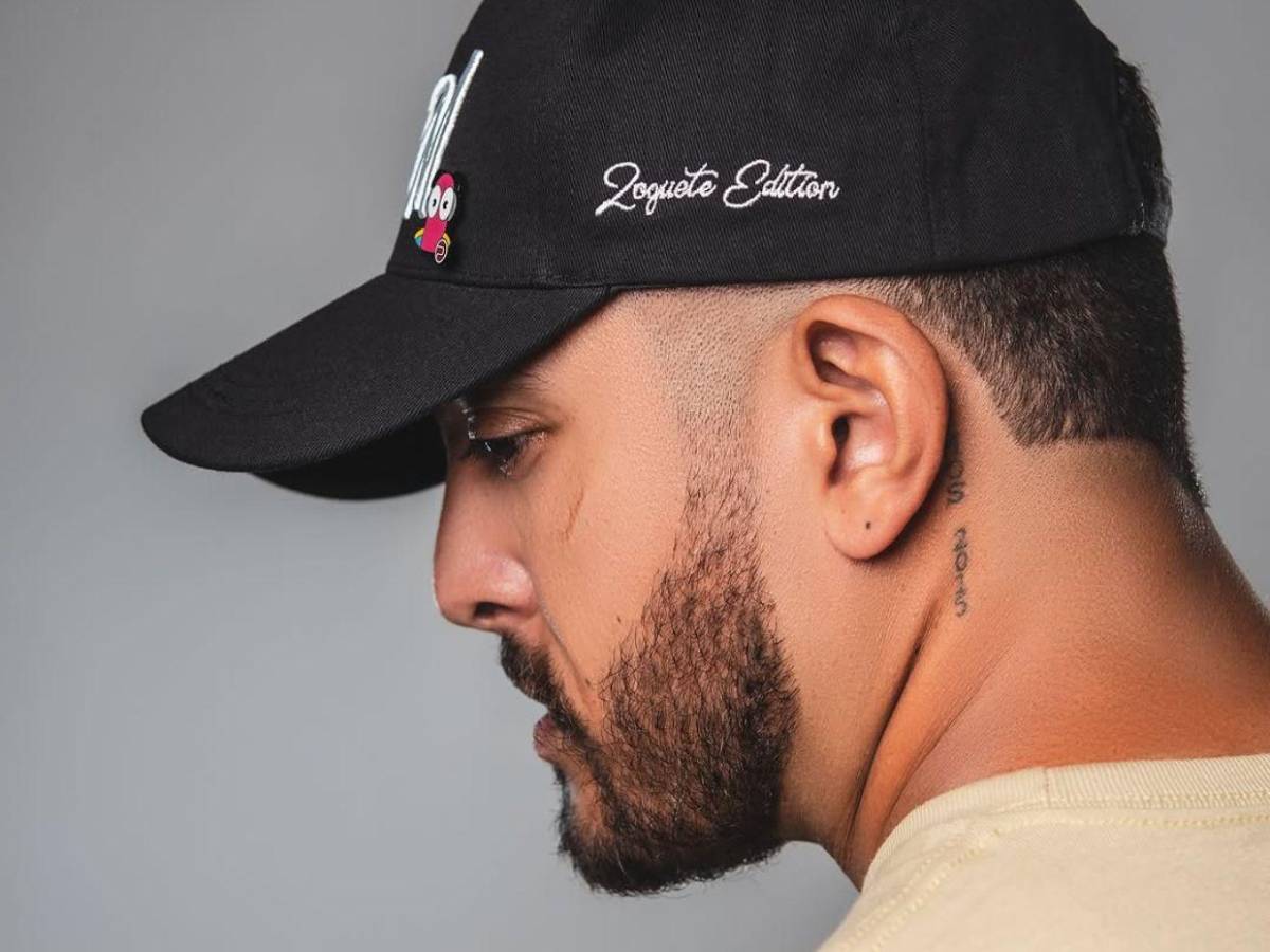 El antes y después de Fancony tras cirugía ortognática: “Soy más feliz que nunca”