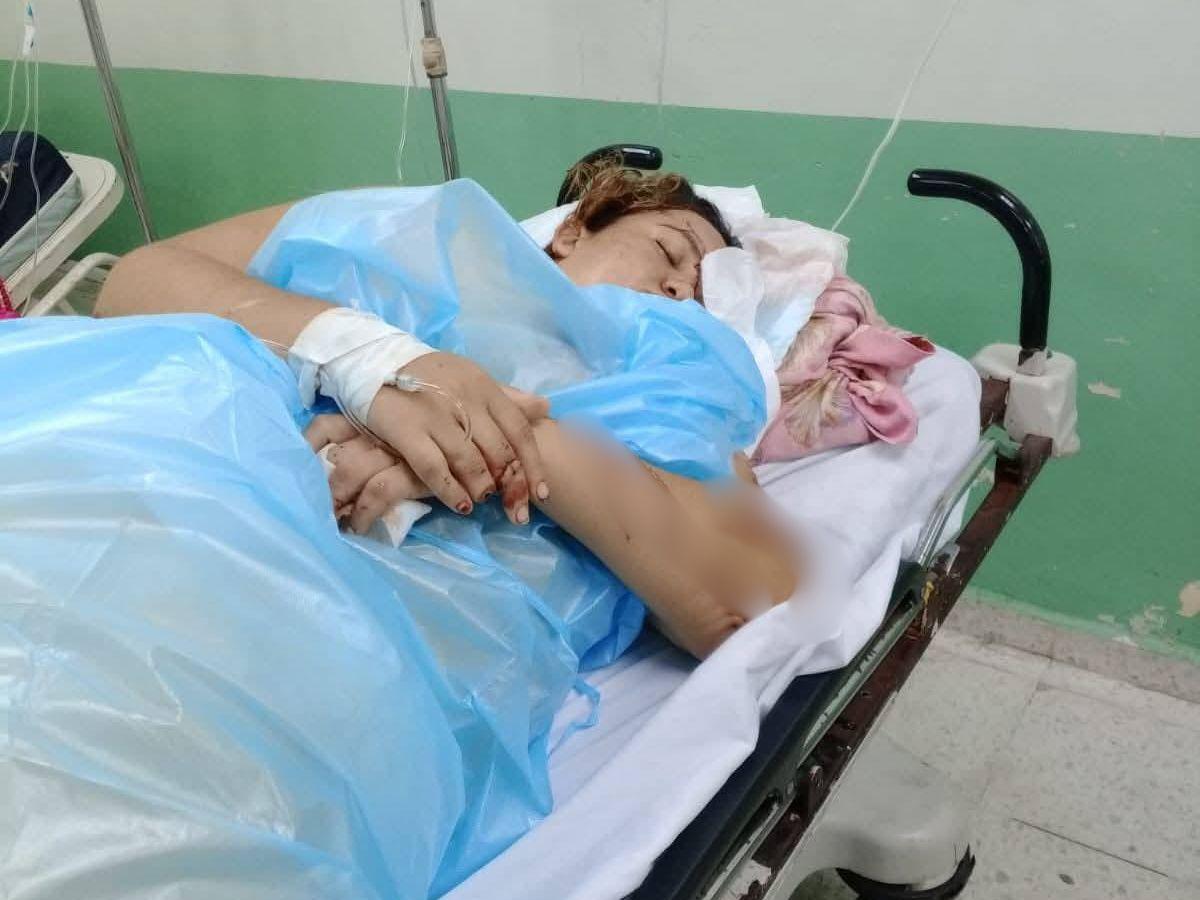 Recibió 30 machetazos: Yensy Guzmán quedó completamente desfigurada tras brutal ataque de su esposo
