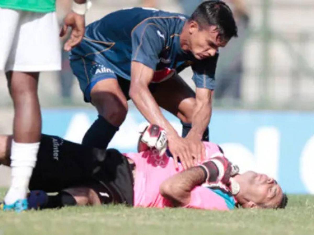Las lesiones más escalofriantes que han ocurrido en el fútbol hondureño