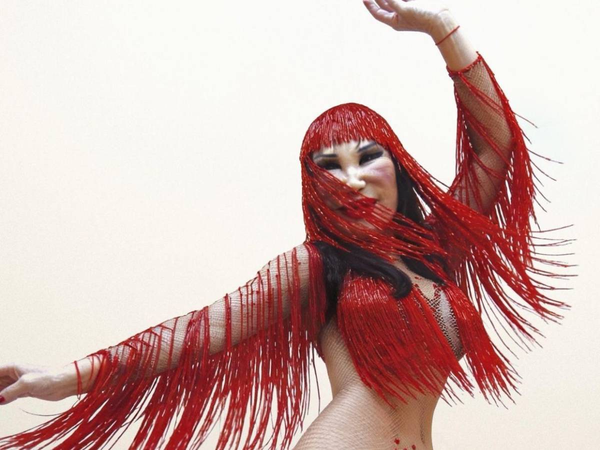 Lyn May y el error estético que deformó su rostro