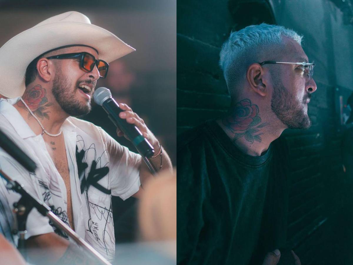 El antes y después de Fancony tras cirugía ortognática: “Soy más feliz que nunca”