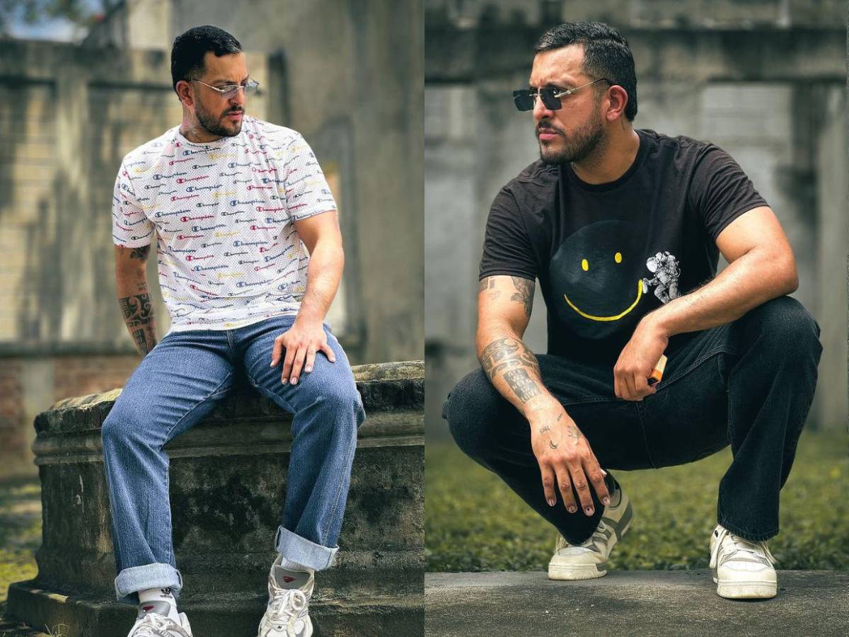 El antes y después de Fancony tras cirugía ortognática: “Soy más feliz que nunca”