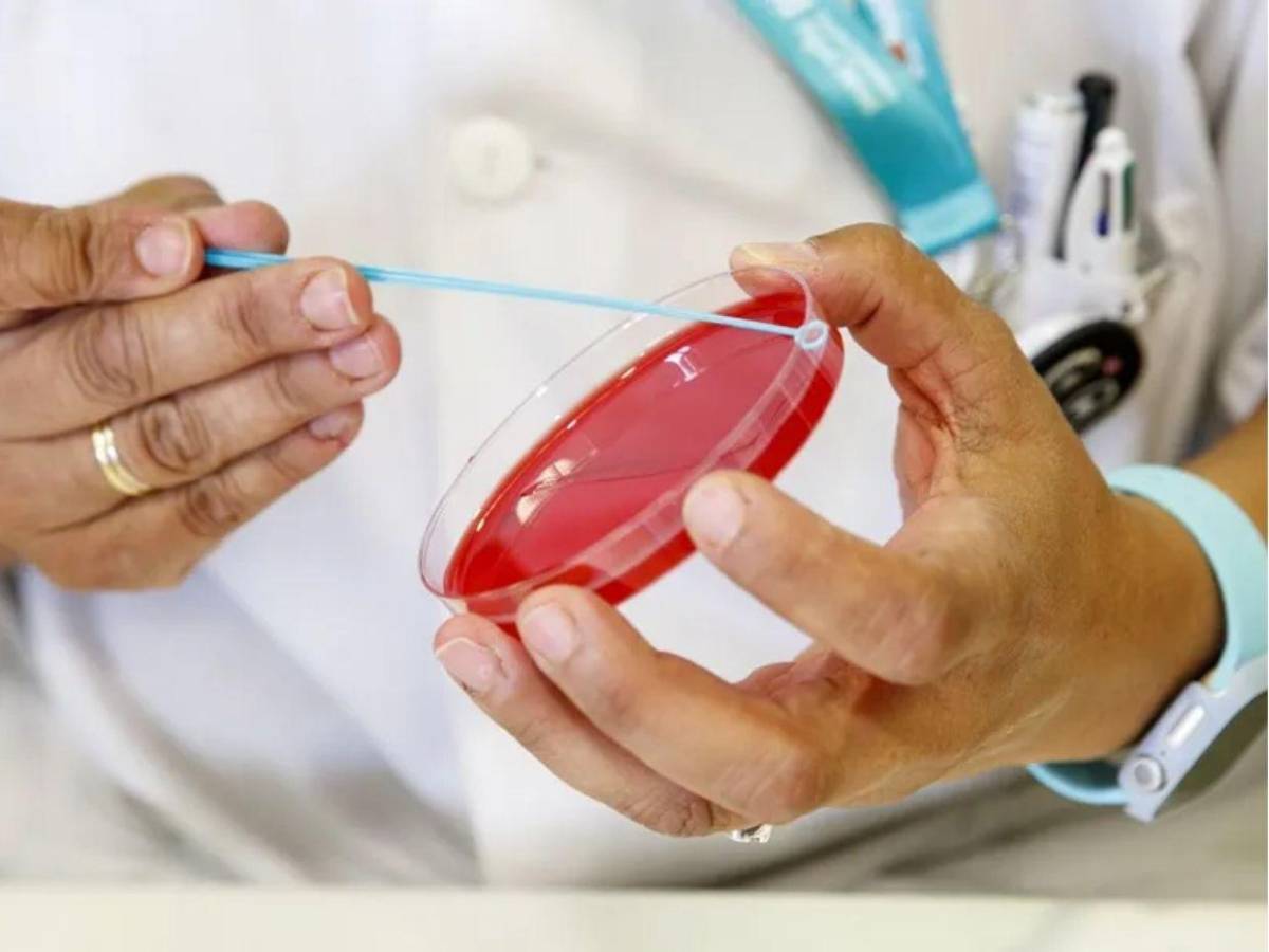 ¿Cuáles son los síntomas del sarampión, la enfermedad que pone en alerta a Honduras?