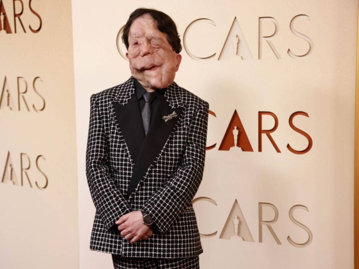 Adam Pearson, el actor con neurofibromatosis que brilló en los Oscar 2026