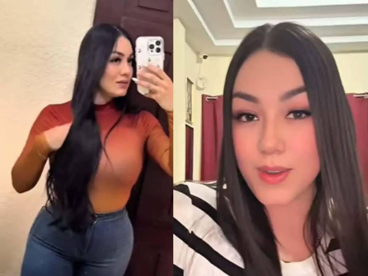 Muere joven nicaragüense tras cirugía estética: Tenía perforación pulmonar