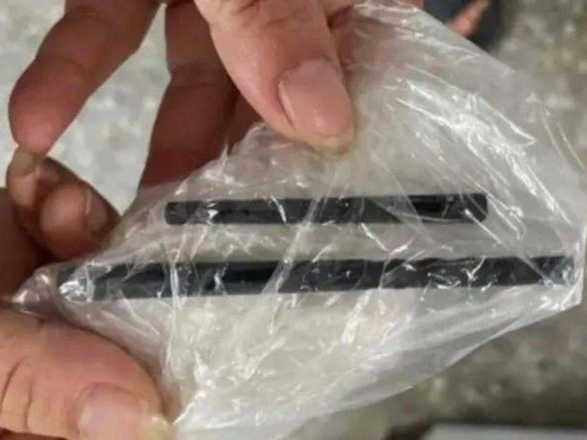 Hombre vivió con palillos en su cráneo por cinco meses sin darse cuenta