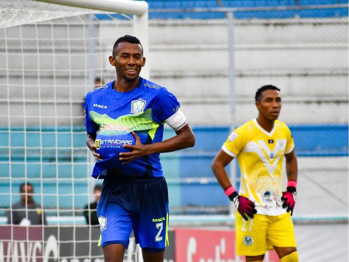 Once titular de las ausencias en la Selección Nacional de Honduras