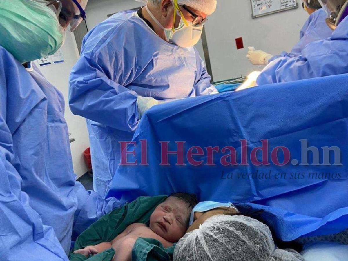 Nacen tres niñas por vitrificación embrionaria en San Pedro Sula