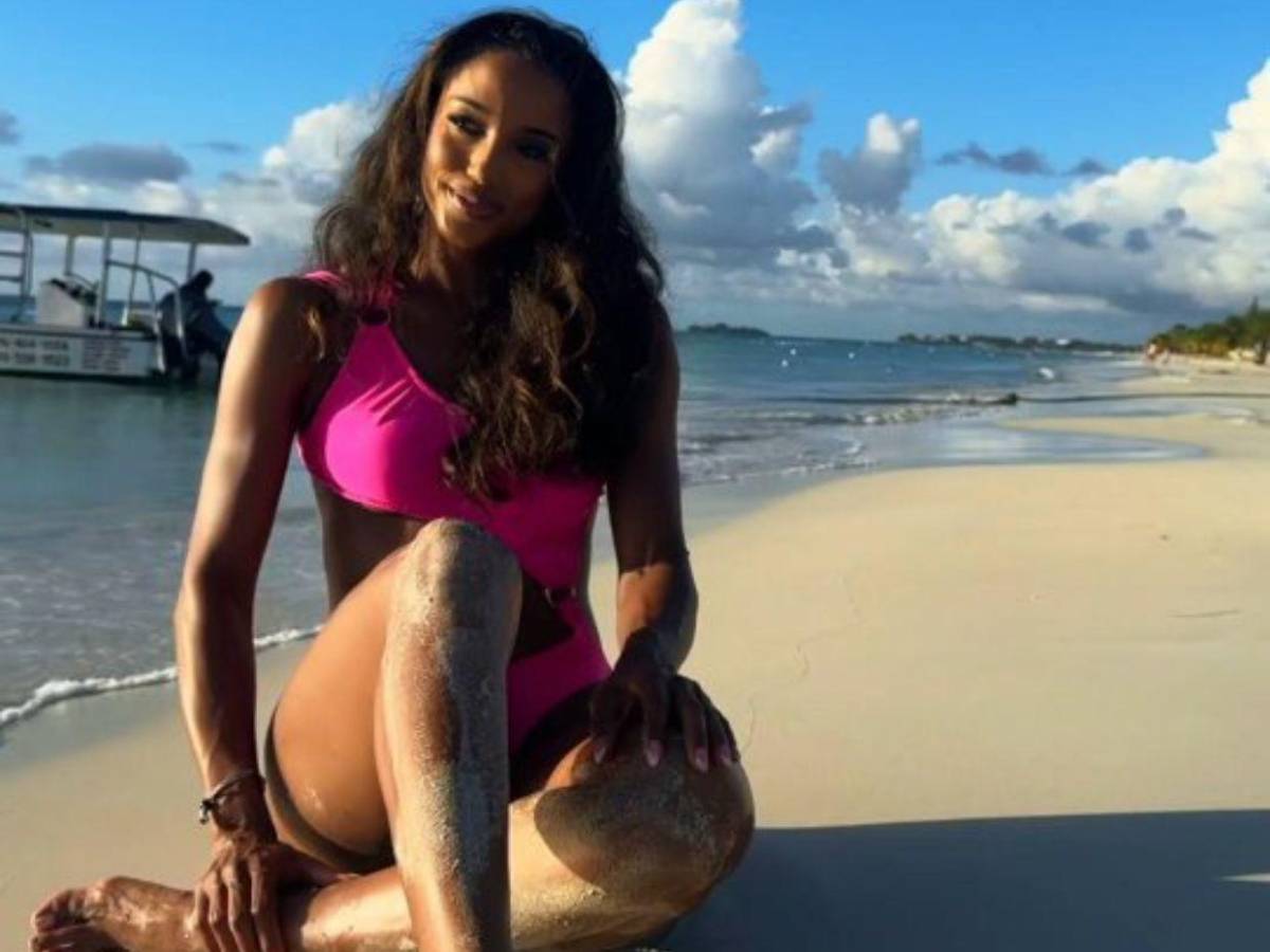 Miss Jamaica: Su estado empeora tras caída en Miss Universo 2025