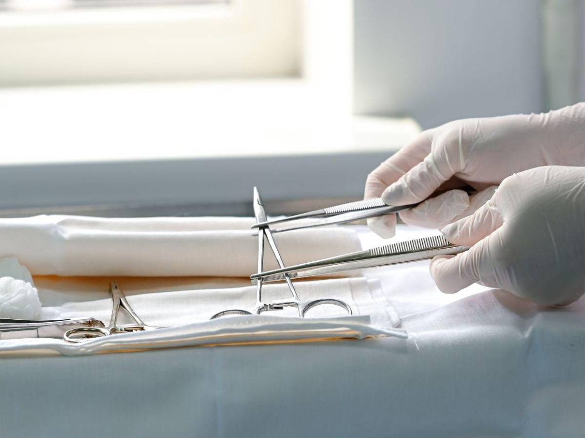 Mujer descubre tijeras olvidadas en su abdomen siete meses después de cirugía estética