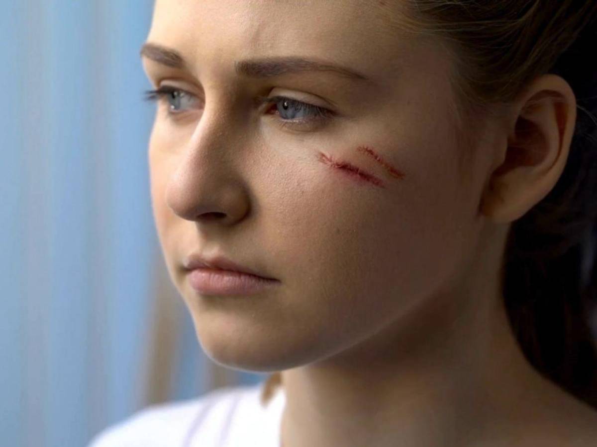 ¿Cuáles son los síntomas de la enfermedad del gusano barrenador en humanos?