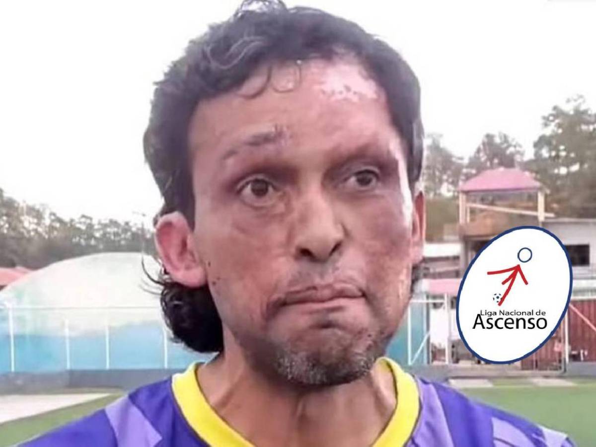 Pedro Joaquín Amador quiere ser convocado a la Selección de Honduras: Las condiciones que puso