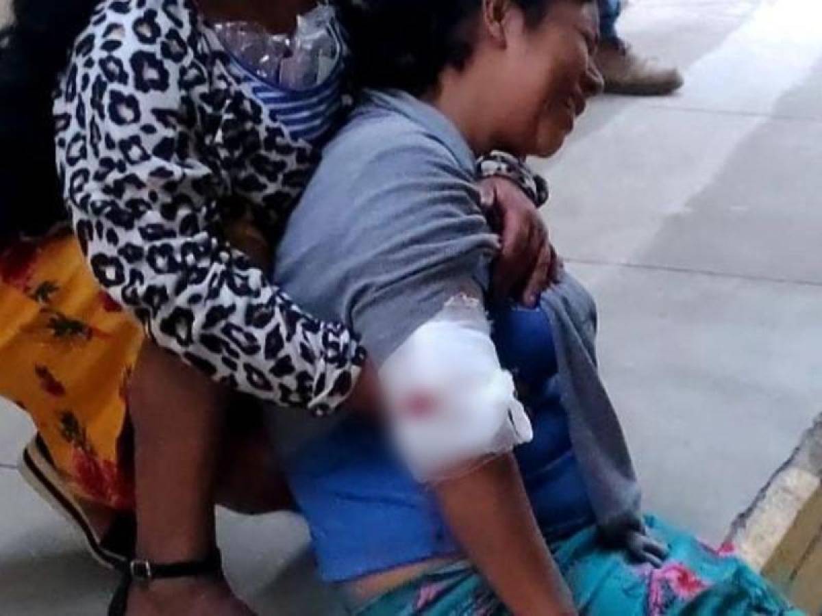 La suegra del agresor resultó herida tras discutir con su yerno porque le estaba pegando a su hija.