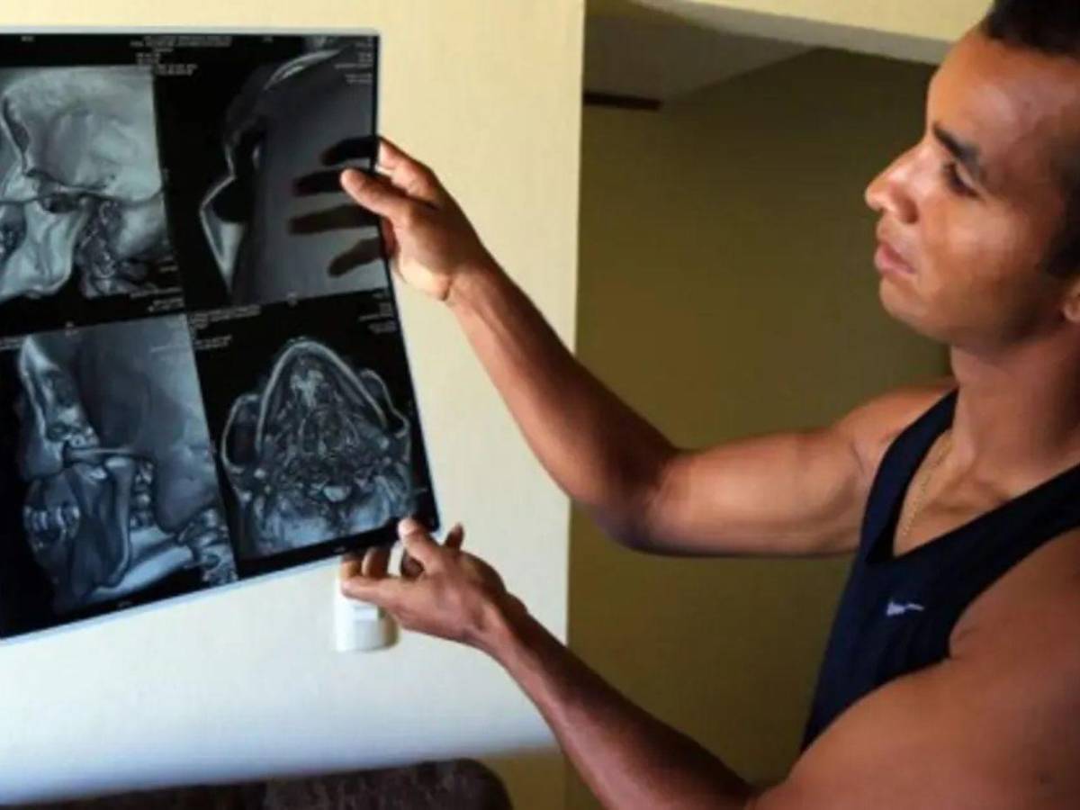 Las lesiones más escalofriantes que han ocurrido en el fútbol hondureño