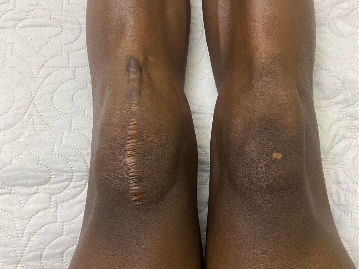 Exfutbolista de Olimpia cuenta su impactante historia: “Psicológicamente me hacían daño”