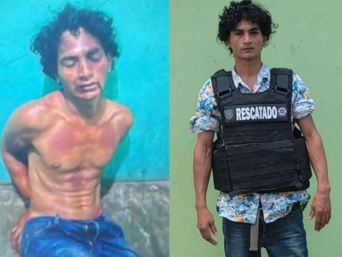 Con salsa de tomate fingió golpes y heridas para exigir pago de rescate a familiares