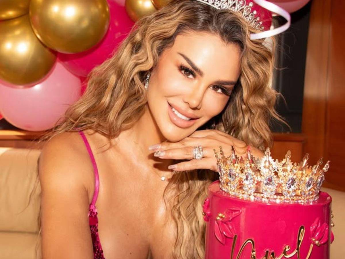 Ninel Conde y el costoso riesgo de la queratopigmentación para tener ojos verdes