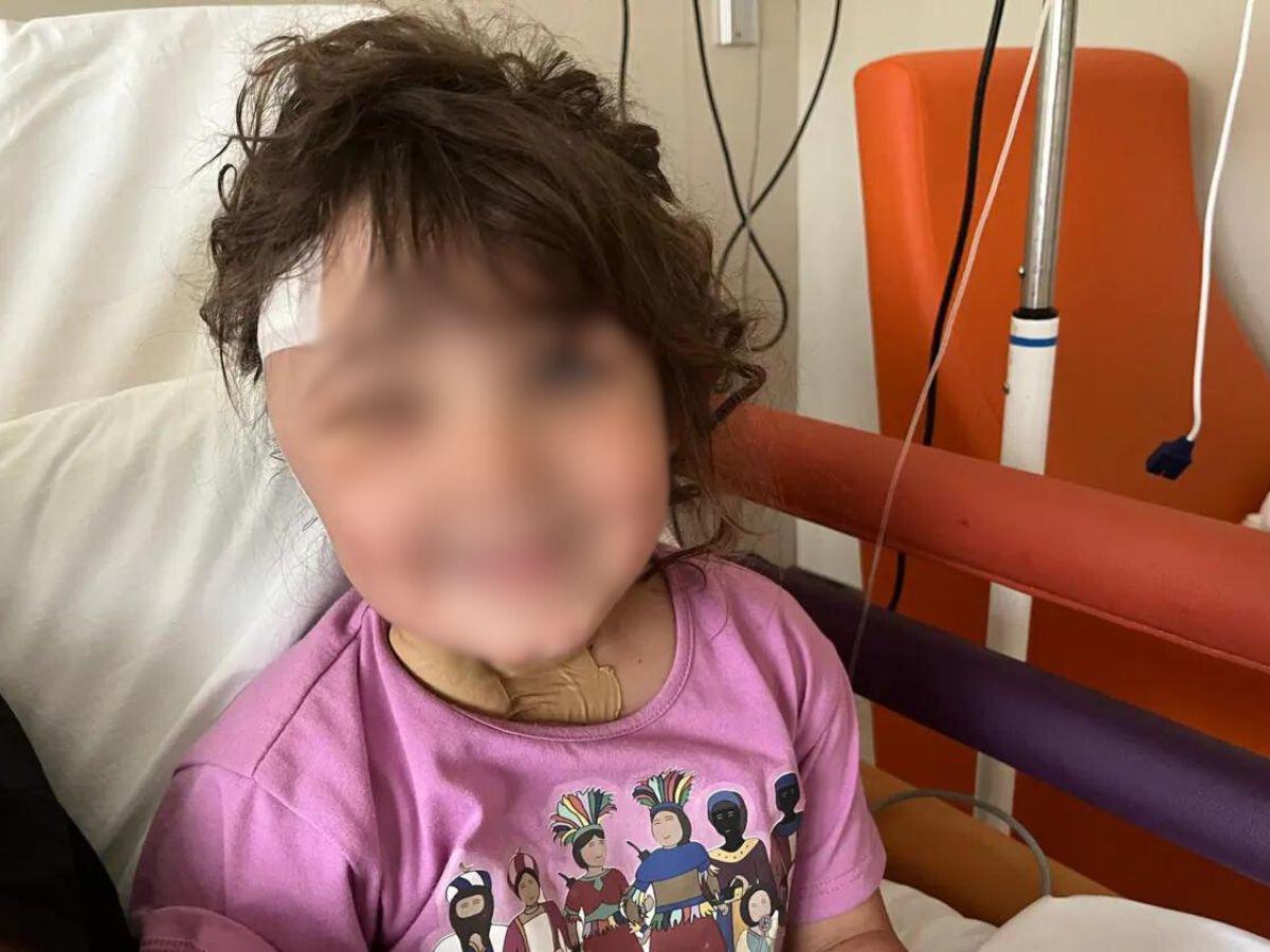 Retiran aguja alojada en el cerebro de niña de cuatro años en Barcelona, España