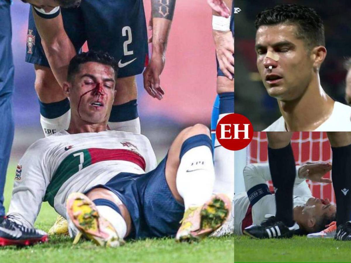 ¡Brutal choque! Cristiano Ronaldo recibe fuerte golpe en partido Portugal vs. República Checa