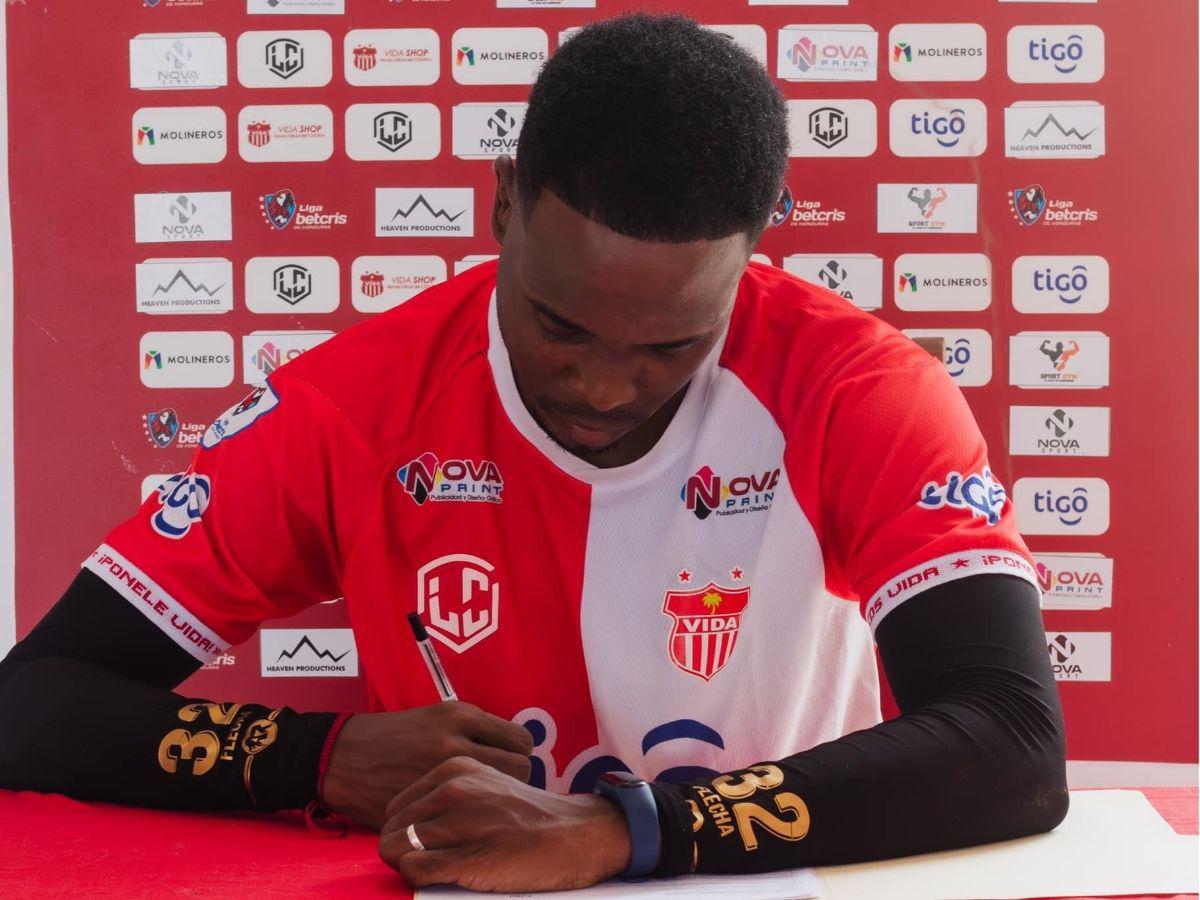 Exfutbolista de Olimpia cuenta su impactante historia: “Psicológicamente me hacían daño”