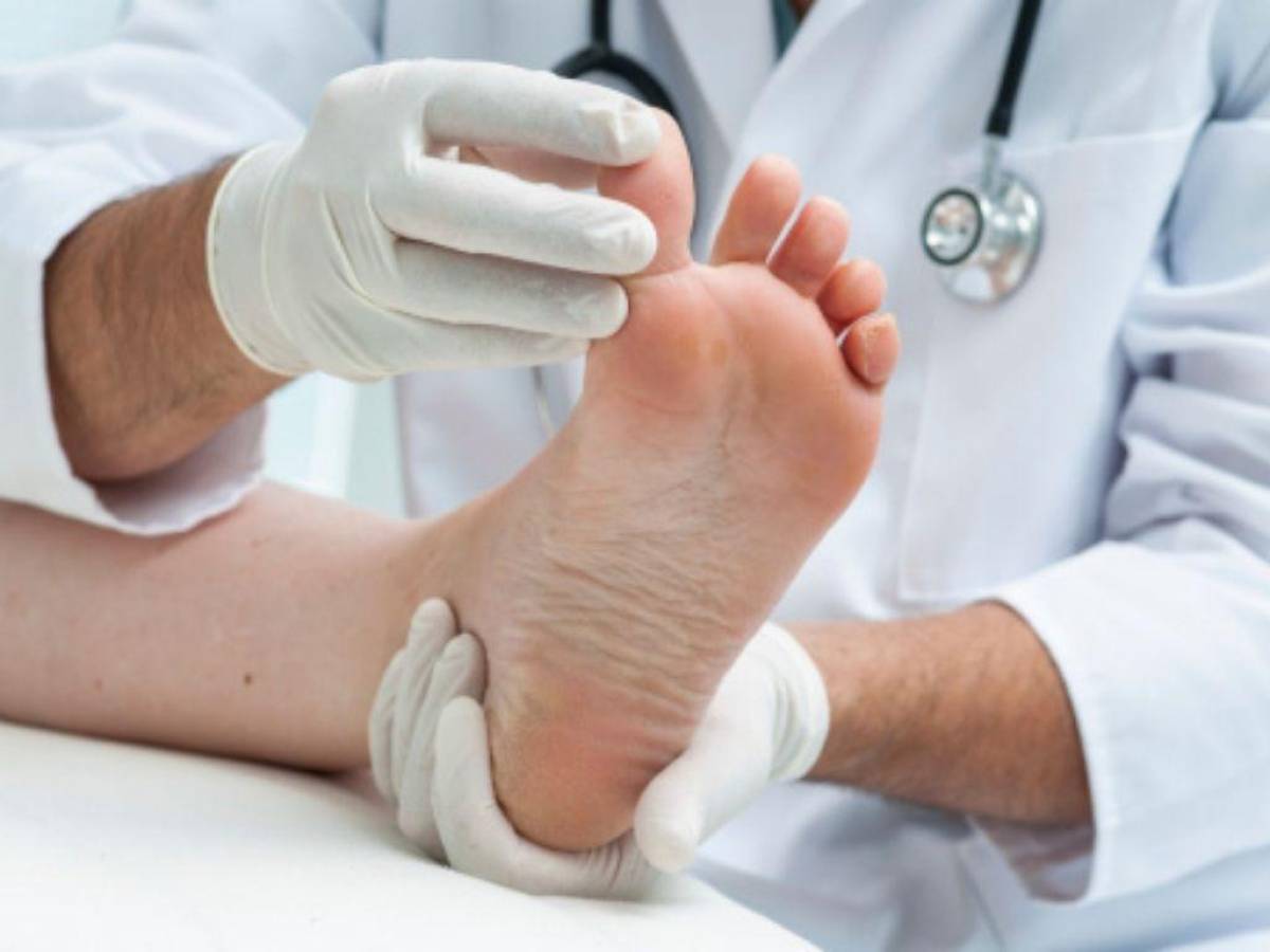 ¿Sufre de inflamación en los pies? Estas son las posibles causas