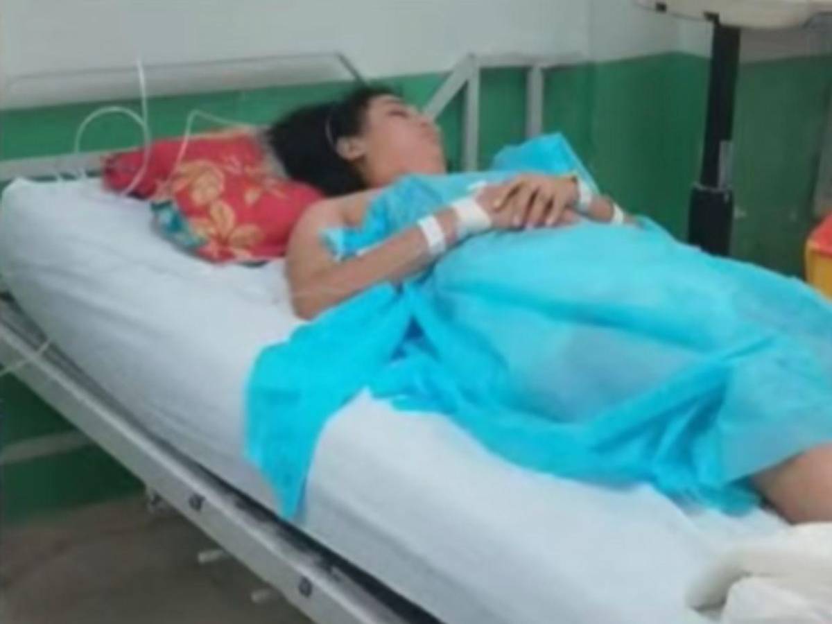 Joven cae de juego mecánico en feria de Santa Rosa de Copán