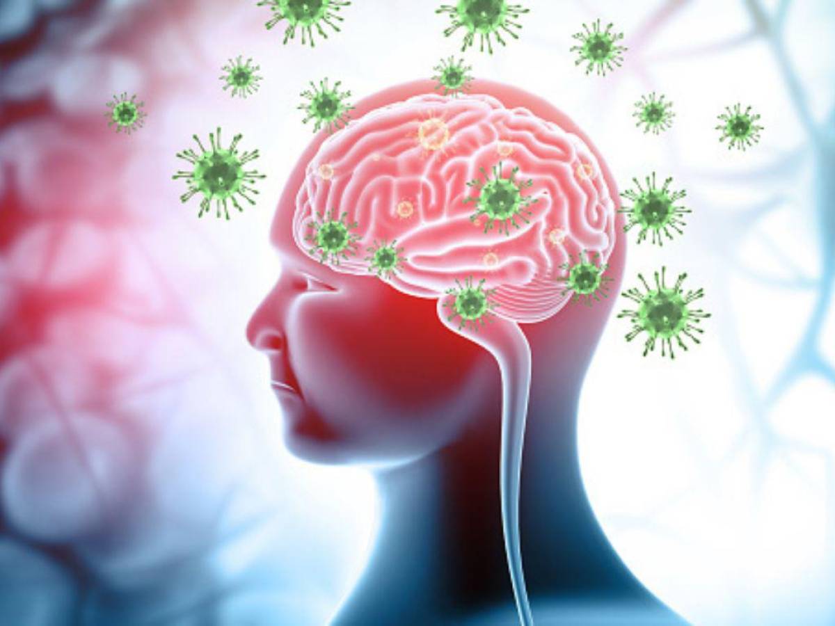 ¿Qué es el henipavirus y cuáles son sus síntomas?