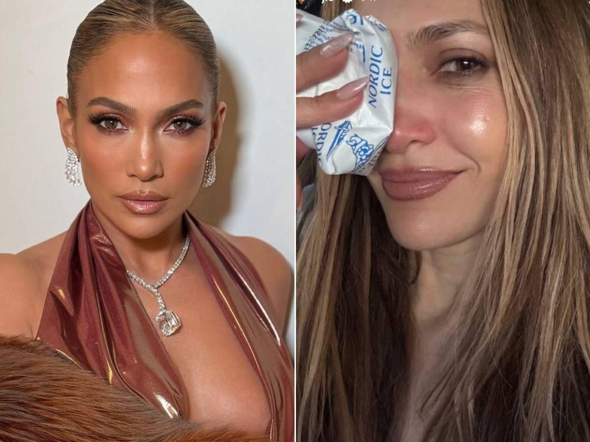 Jennifer López sufre lesión en el rostro tras un accidente en escenario
