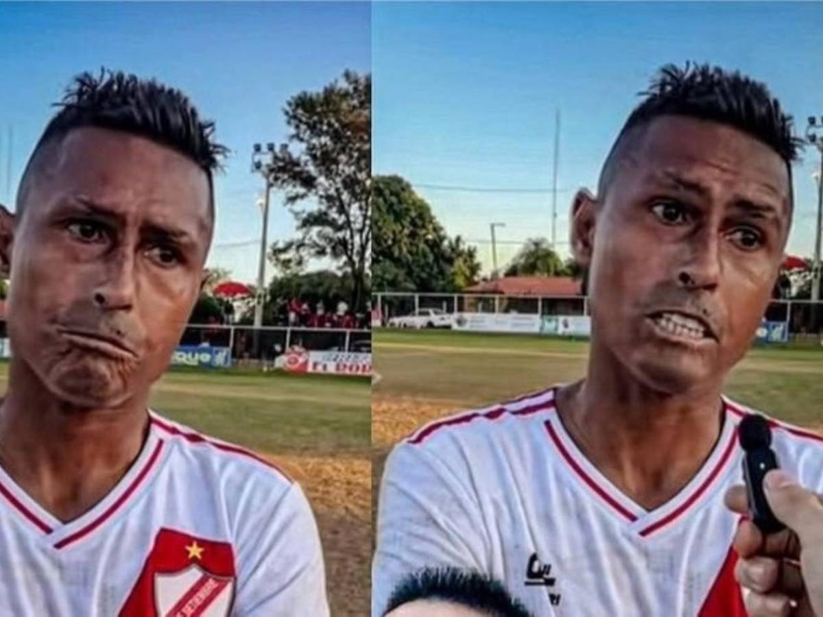 Osvaldo Martínez: ¿Qué enfermedad sufre y cuáles son sus consecuencias?