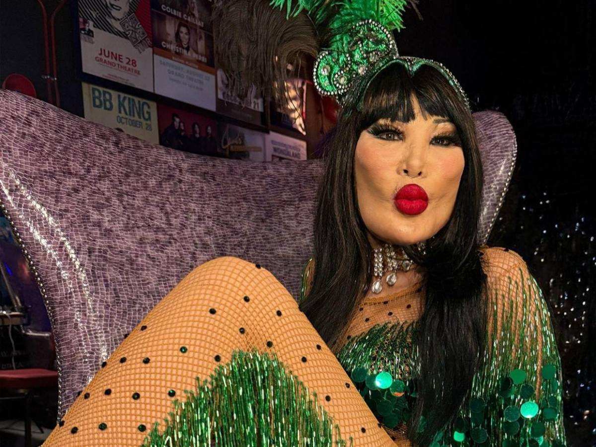 Lyn May y el error estético que deformó su rostro