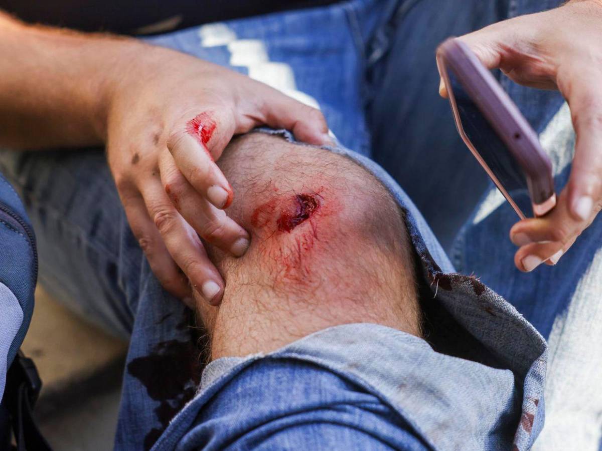 La comunidad de Los Ángeles se resiste a doblegar; siguen protestas