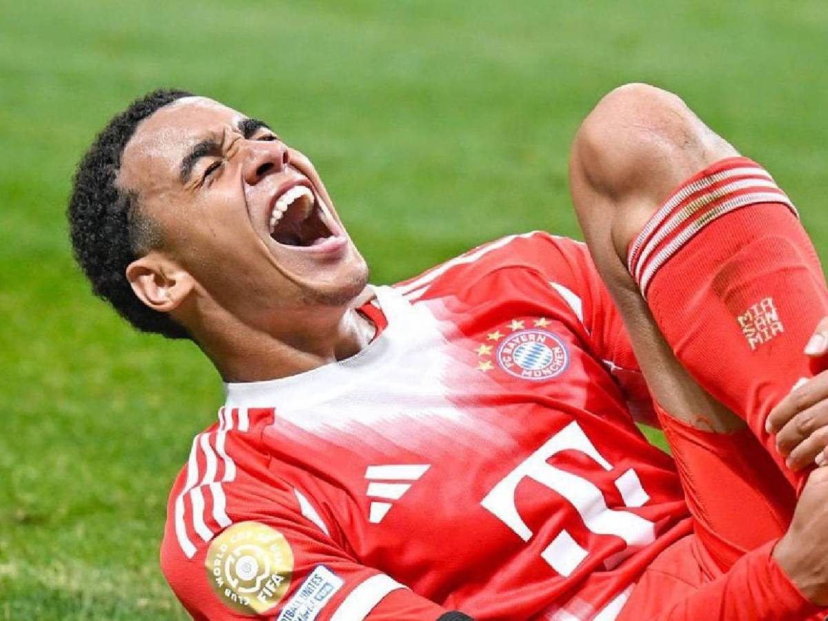 Bayern Múnich confirma la lesión de Jamal Musiala: Esta es la preocupación del club