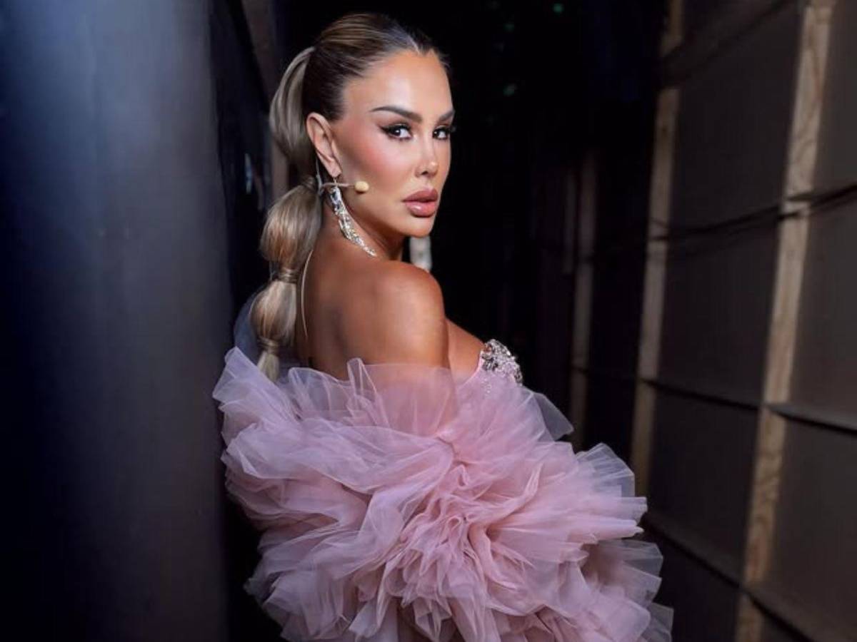 Ninel Conde y el costoso riesgo de la queratopigmentación para tener ojos verdes