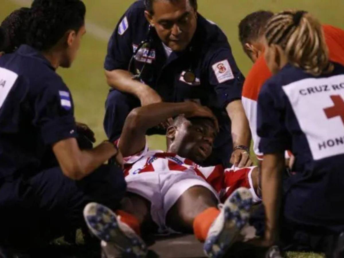 Las lesiones más escalofriantes que han ocurrido en el fútbol hondureño