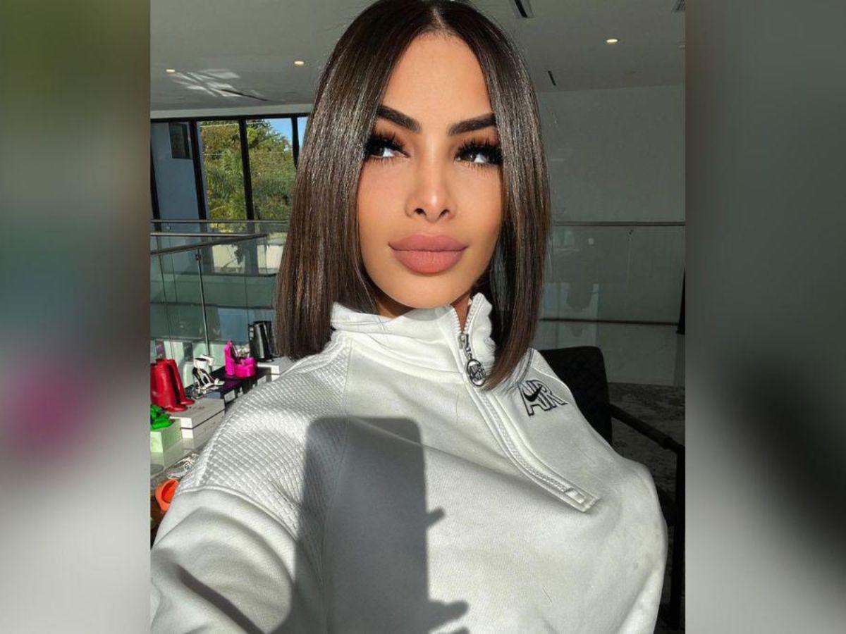 Yailin, la más viral, muestra cómo luce luego de su cirugía